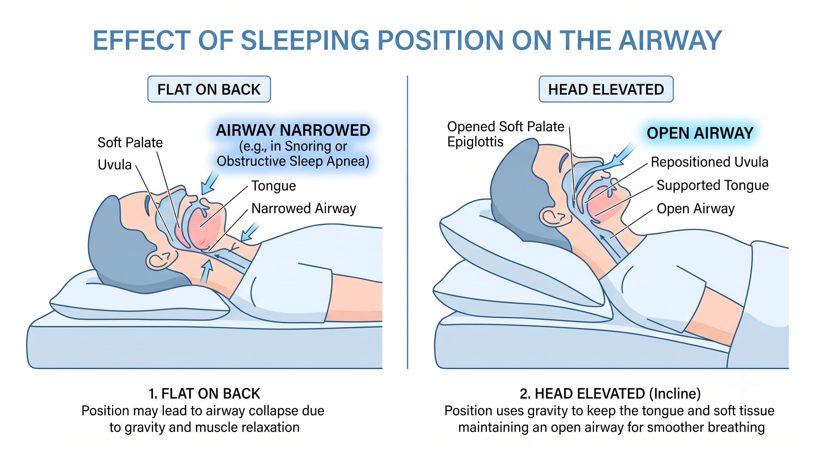 Airway Position Diagram Airway Position Diagram